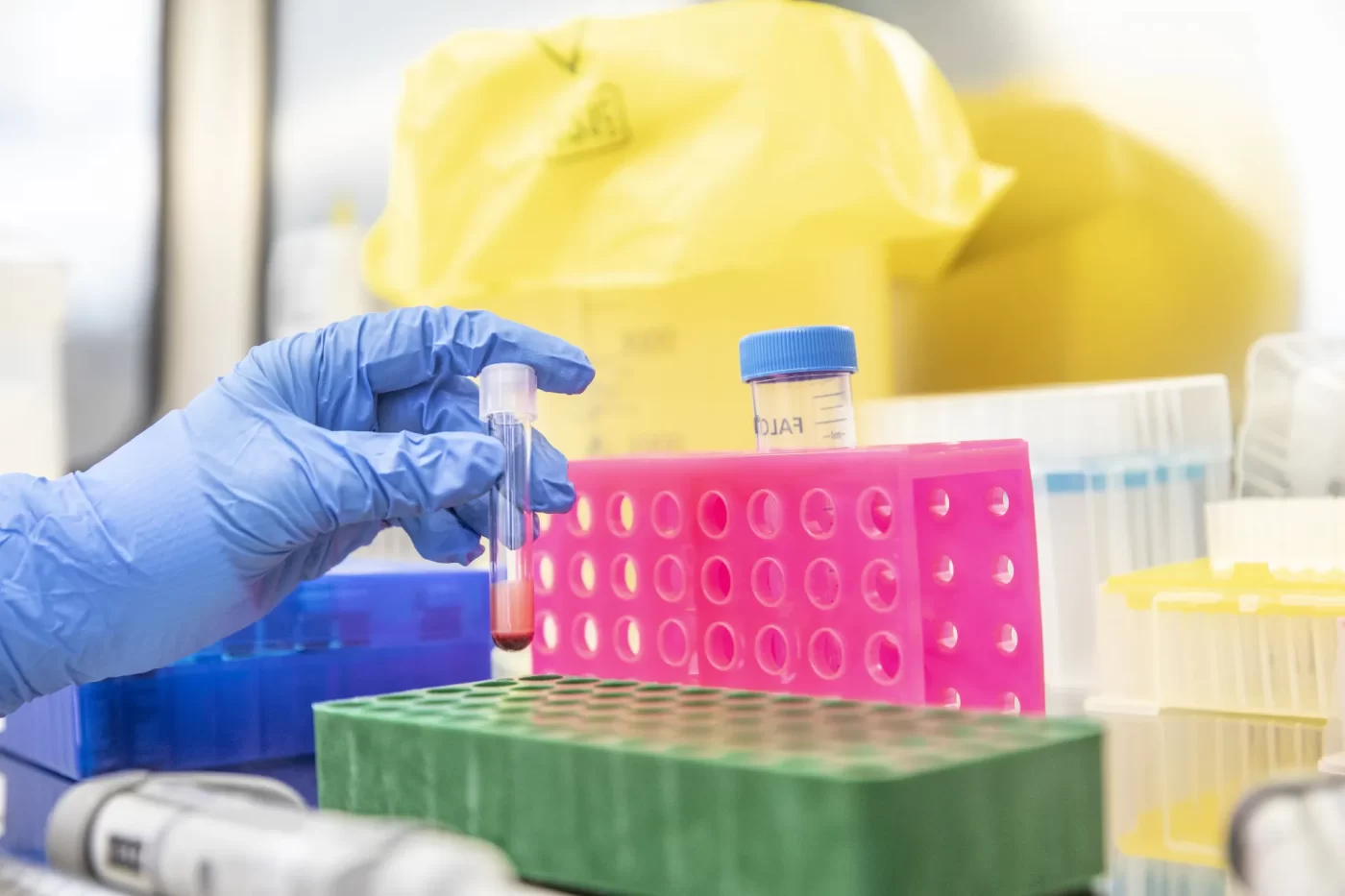 Scientist preparing clinical samples in biosafety cabinet for assay