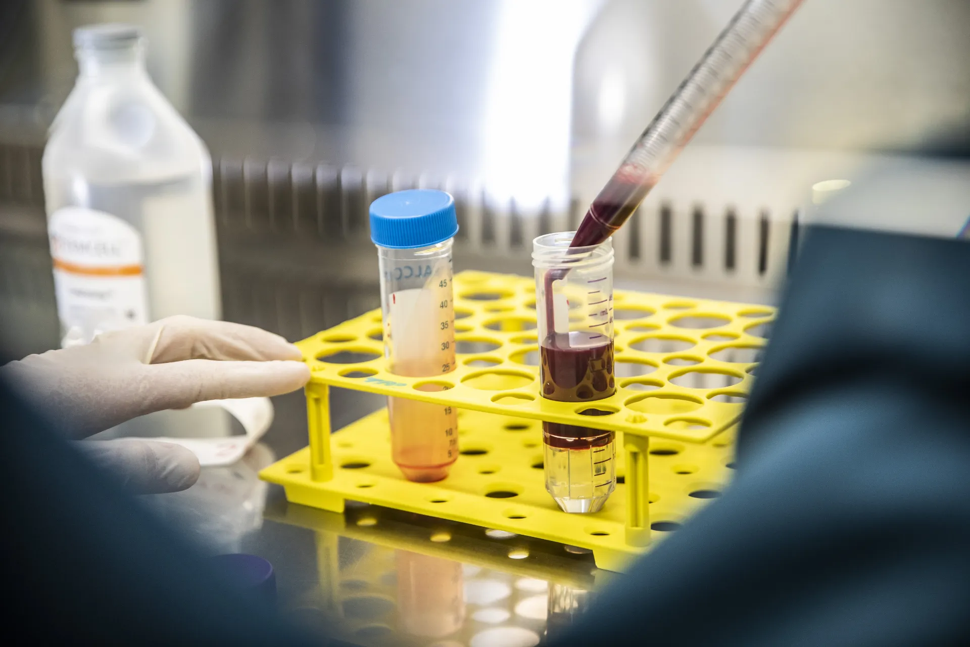 Scientist isolating PBMCs from whole blood via traditional ficoll underlay