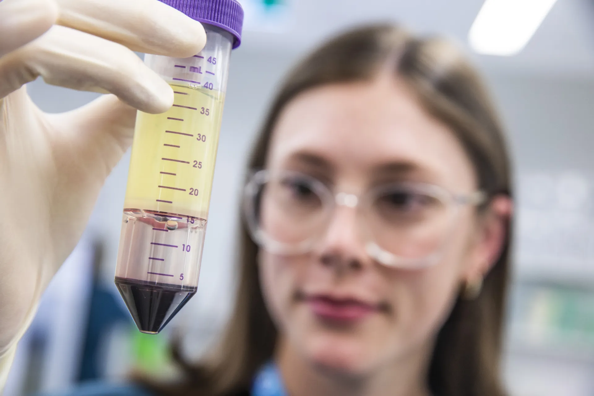 Scientist isolating the Peripheral Blood Mononuclear Cells (PBMC) layer between plasma and ficoll density gradient medium